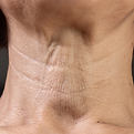 15.png