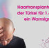 Baldköpfiger Mann hält sich den Kopf; magenta Text: Haartransplantation in der Türkei für 1.490 € – ein Warnsignal?