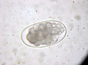 tapeworm eggs.jpg