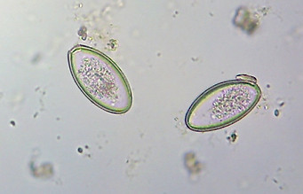 Pinworm-Eggs.jpg