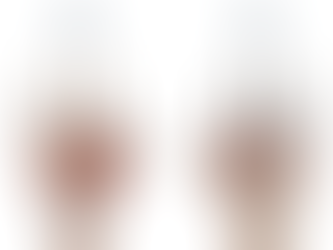 麻痺手の内在筋について考える