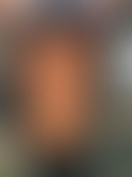 'I cut myself so I don't hurt others' Self harm in Moria