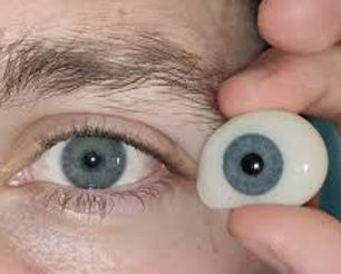 Prótesis Oculares