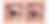 Before and After Eye