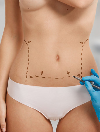 woman-marked-out-cosmetic-surgery.jpg