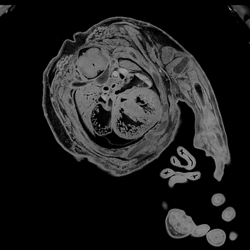 2D Mouse section showing embryonic heart in cross section highlighting each chamber