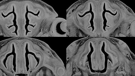 Serial Block Face Images of Optical HREM Mouse Section