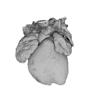 Embryonic Mouse Heart imaged using High Resolution Episcopic Microscopy (HREM)
