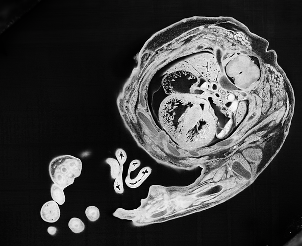 HREM Micro Mouse Embryo Block Face Cross Section.png