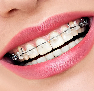 AdobeStock_83005084_web_square.jpg