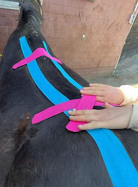 Kinesiotaping