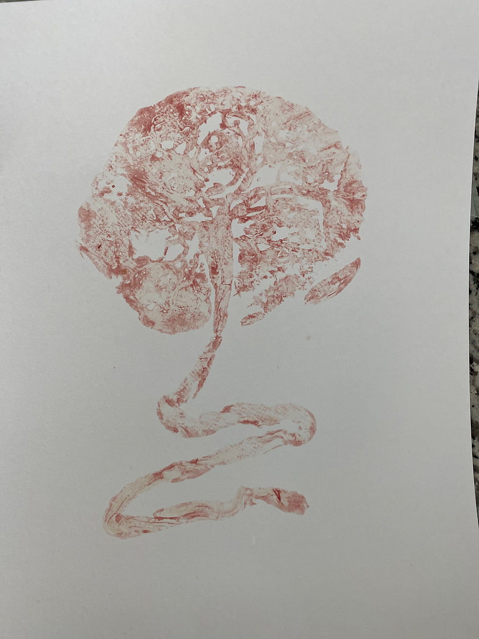 Placenta Print