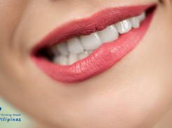 The Perfect Smile