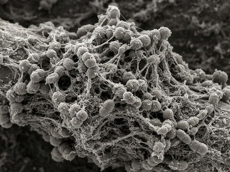 Enterococcus faecalis Resistente a Antibióticos: Por Que a Resistência Antimicrobiana Preocupa?