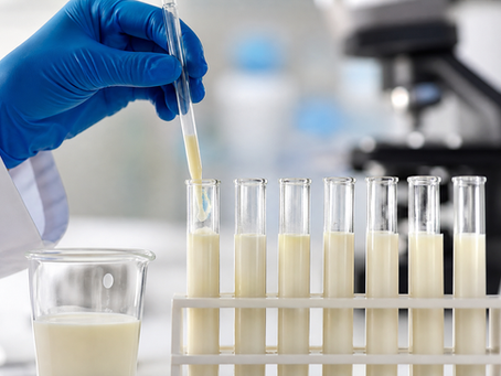 Métodos laboratoriais para determinação de matéria gorda em produtos lácteos