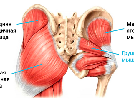 Синдром грушевидной мышцы