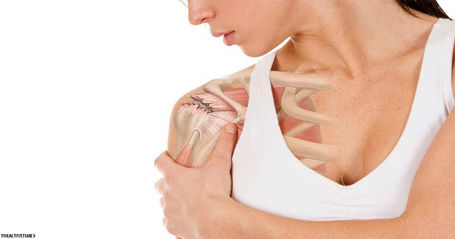 Боль в плечевом суставе