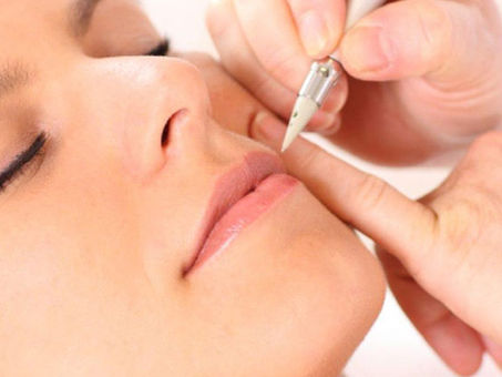 Epilation définitive électrique 