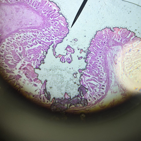Image of intestine