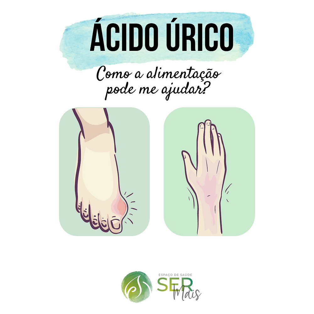 O que pode causar ácido úrico elevado? Como a nutrição pode te ajudar?