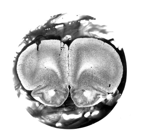 Noggin Talk Silver Gelatin Prints 