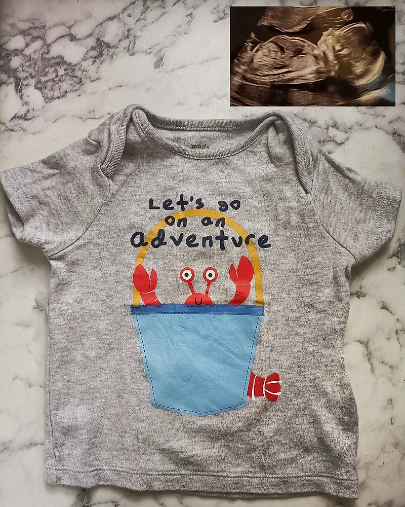 Travelling in early pregnancy top tips for a first trimester holiday