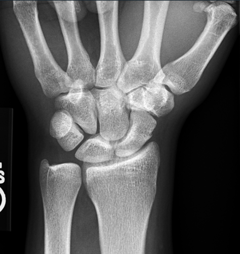 Extremity Module | psrxray