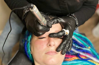 Tattooing-Freckles_2.jpg