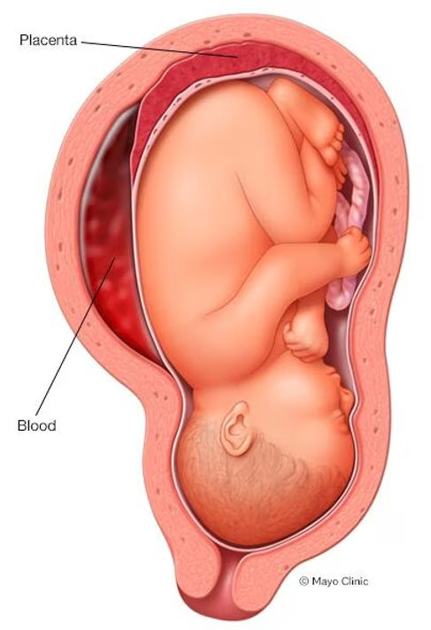 Fetal Growth