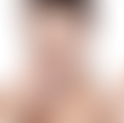 💧DEVI BERE PIU' ACQUA...ti spiego perché!