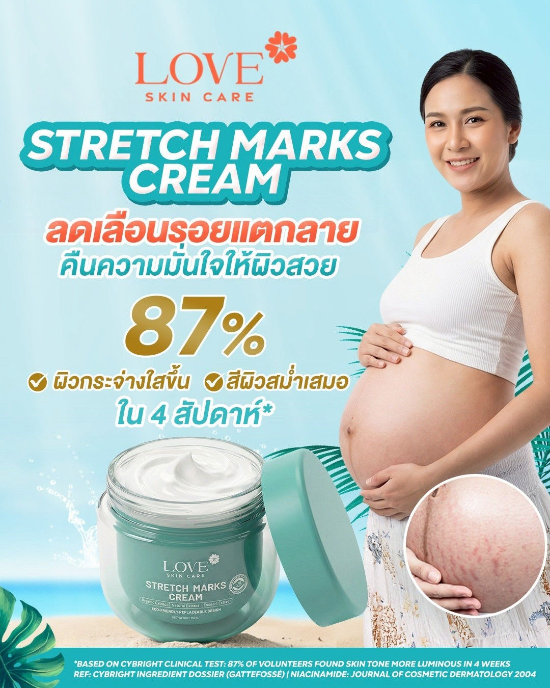 Refill - Stretch Marks Cream (รีวิว)