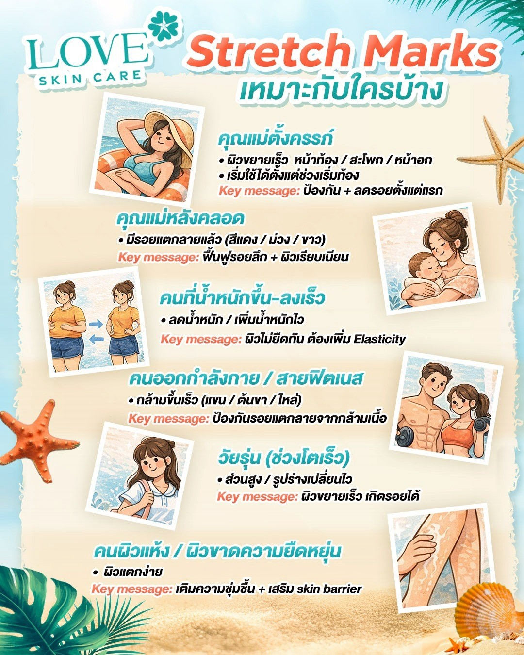 Refill - Stretch Marks Cream (รีวิว)
