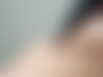 Transform Your Skin with Bio Microneedling: Advantages of Bio Microneedling