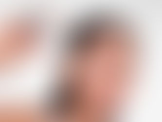 Creamy e a nova geração de tratamentos para hiperpigmentação