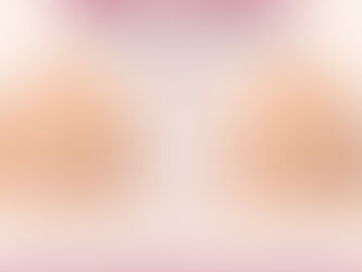 Why a 285cc Silicone Breast Implant on My Friend Looks Different on My Body