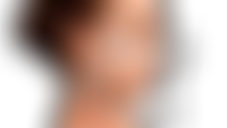 Harmonização Facial Definitiva