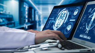 brain scans
