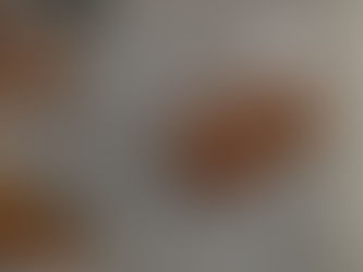 Sleep Patterns and Risk of New-Onset Stress Urinary Incontinence: The UK Biobank Prospective Cohort Study