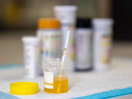 Rapid UTI Test Delivers Faster, More Accurate Antibiotic Treatment