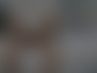 Frailty-Associated Urinary Tract Infections (FAUTIs)