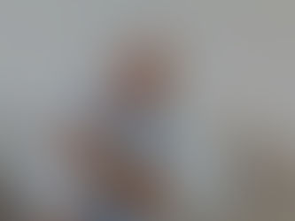 Prevalence and impact of sarcopenia on urinary incontinence in localized prostate cancer patients undergoing laparoscopic radical prostatectomy