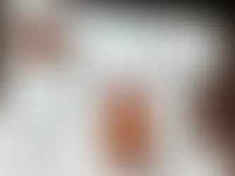 PET Imaging in Primary Diagnosis of Prostate Cancer