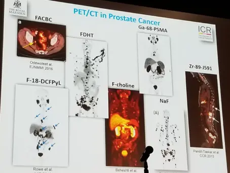 PET Imaging in Primary Diagnosis of Prostate Cancer
