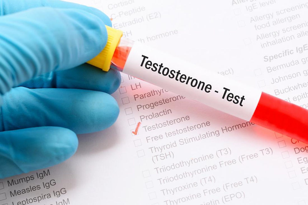 Testosterone thấp và những thông tin cần biết