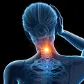 Neck Pain