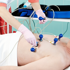 Eletrocardiograma