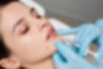 close-up-woman-getting-lip-fillers.jpg