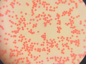 Observation du sang au microscope