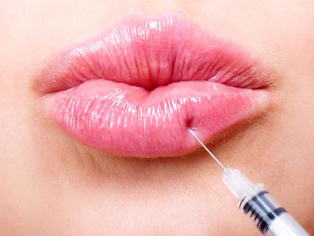 Juvederm Fillers in Dubai