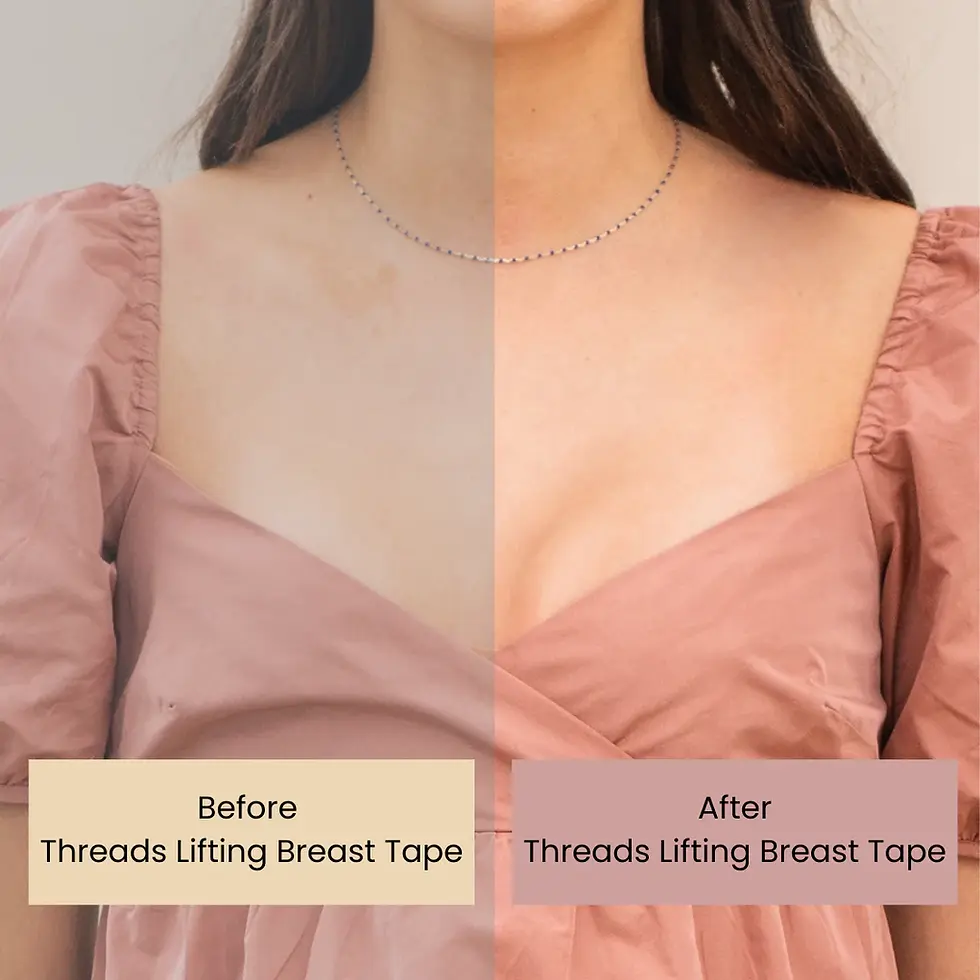 Thumbnail: Threads Lifting Breast Tape, before and after